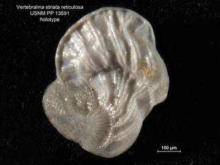 To NMNH Paleobiology Collection (Vertebralina striata reticulosa PP13591 holo 2)
