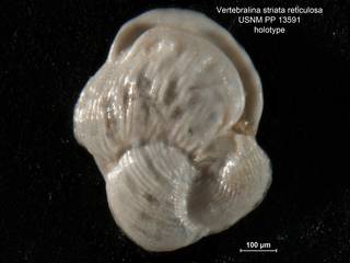 To NMNH Paleobiology Collection (Vertebralina striata reticulosa PP13591 holo 1)