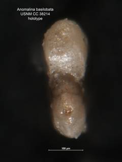To NMNH Paleobiology Collection (Anomalina basilobata CC 38214 holo 3)