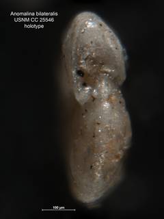 To NMNH Paleobiology Collection (Anomalina bilateralis CC 25546 holo 3)