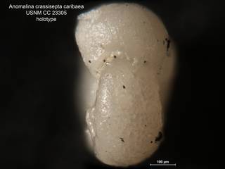 To NMNH Paleobiology Collection (Anomalina crassisepta caribaea CC 23305 holo 2)