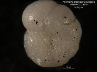 To NMNH Paleobiology Collection (Anomalina crassisepta caribaea CC 23305 holo 3)