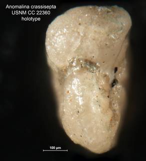 To NMNH Paleobiology Collection (Anomalina crassisepta CC 22360 holo2)