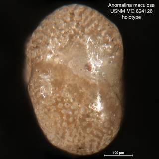 To NMNH Paleobiology Collection (Anomalina maculosa MO 624126 holo 2)