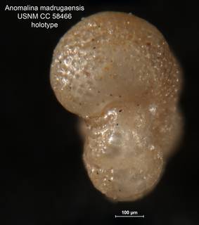 To NMNH Paleobiology Collection (Anomalina madrugaensis CC 58466 holo 2)
