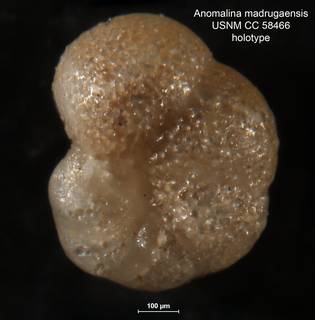 To NMNH Paleobiology Collection (Anomalina madrugaensis CC 58466 holo 3)