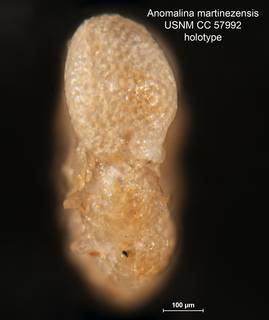 To NMNH Paleobiology Collection (Anomalina martinezensis CC 57992 holo 2)