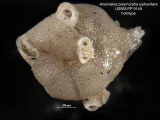 To NMNH Paleobiology Collection (Anomalina polymorpha siphonifera PP 9149 holo 1)