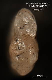 To NMNH Paleobiology Collection (Anomalina redmondi CC 64579 holo 2)