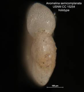 To NMNH Paleobiology Collection (Anomalina semicomplanata CC 15254 holo 2)