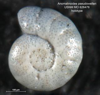 To NMNH Paleobiology Collection (Anomalinoides pseudowelleri MO626476 holo 1)