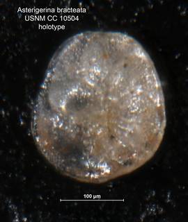 To NMNH Paleobiology Collection (Asterigerina bracteata CC10504 holo 1)