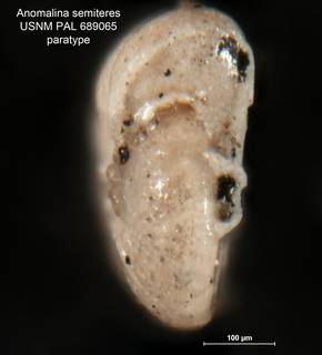 To NMNH Paleobiology Collection (Anomalina semiteres MO 689065 para 2)