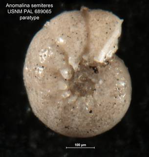 To NMNH Paleobiology Collection (Anomalina semiteres MO 689065 para 1)