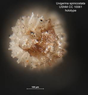 To NMNH Paleobiology Collection (Uvigerina spinicostata CC10061 holo 2)