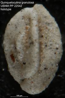 To NMNH Paleobiology Collection (Quinqueloculina granulosa USNM PP 22542 holotype)
