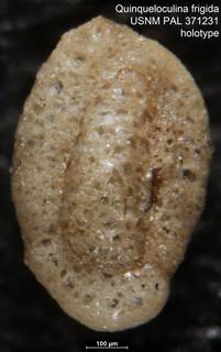 To NMNH Paleobiology Collection (Quinqueloculina frigida USNM PAL 371231 holotype 1)