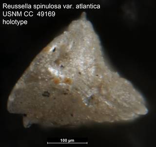To NMNH Paleobiology Collection (Reussella spinulosa var. atlantica USNM CC  49169 holotype 2)