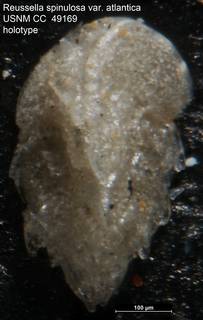 To NMNH Paleobiology Collection (Reussella spinulosa var. atlantica USNM CC  49169 holotype)