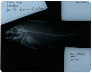 To NMNH Extant Collection (Latridopsis ciliaris RAD107397-001)