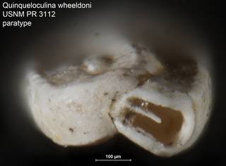 To NMNH Paleobiology Collection (Quinqueloculina wheeldoni USNM PR 3112 paratype ap)