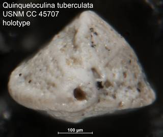 To NMNH Paleobiology Collection (Quinqueloculina tuberculata USNM CC 45707 holotype ap)