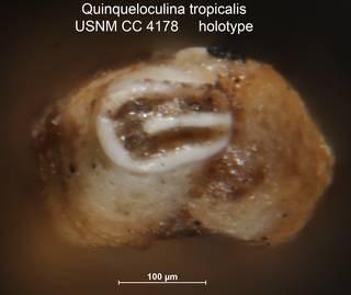 To NMNH Paleobiology Collection (Quinqueloculina tropicalis USNM CC 4178 holotype ap)