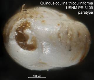 To NMNH Paleobiology Collection (Quinqueloculina triloculiniforma USNM PR 3109 paratype ap)