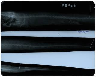 To NMNH Extant Collection (Silvesterina parvibranchialis RAD107760-001)