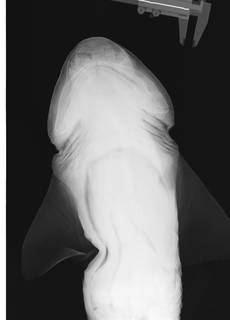 To NMNH Extant Collection (Cephaloscyllium isabellum USNM 176801 radiograph)