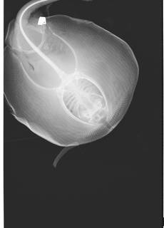 To NMNH Extant Collection (Urolophus USNM 205519 radiograph dorsal view anterior)