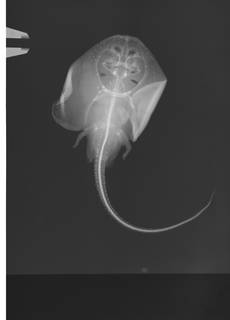 To NMNH Extant Collection (Fenestraja sinusmexicanus USNM 222191 radiograph)