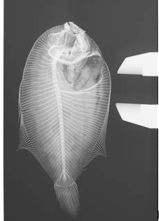 To NMNH Extant Collection (Engyprosopon hawaiiensis USNM 50657 Type radiograph)