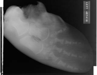 To NMNH Extant Collection (USNM 487416 Physeter catodon Radiograph 002)