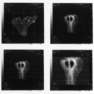 To NMNH Extant Collection (USNM 395632 Mesoplodon sp Radiograph 001)