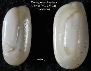 To NMNH Paleobiology Collection (Quinqueloculina lata USNM PAL 371236 paratypes)