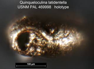 To NMNH Paleobiology Collection (Quinqueloculina latidentella USNM PAL 469998 holotype ap)