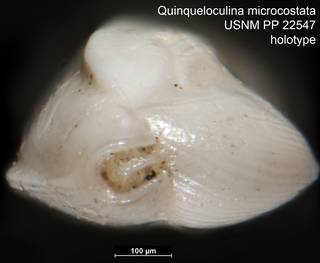 To NMNH Paleobiology Collection (Quinqueloculina microcostata USNM PP 22547 holotype ap)