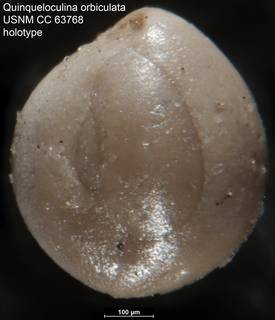 To NMNH Paleobiology Collection (Quinqueloculina orbiculata USNM CC 63768 holotype)