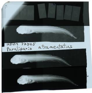 To NMNH Extant Collection (Paraliparis atramentatus RAD112084-001)
