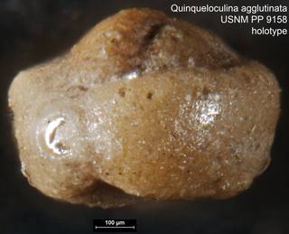 To NMNH Paleobiology Collection (Quinqueloculina agglutinata USNM PP 9158 holotype ap)