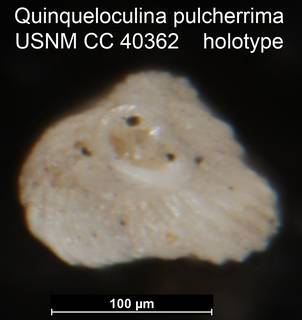 To NMNH Paleobiology Collection (Quinqueloculina pulcherrima USNM CC 40362 holotype ap)