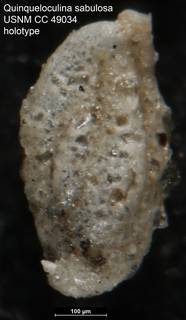 To NMNH Paleobiology Collection (Quinqueloculina sabulosa USNM CC 49034 holotype)