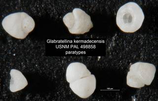 To NMNH Paleobiology Collection (Glabratellina kermadecensis USNM PAL 498858 paratypes)