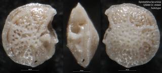 To NMNH Paleobiology Collection (Epistomina lacunosa USNM CC 45660 holotype)
