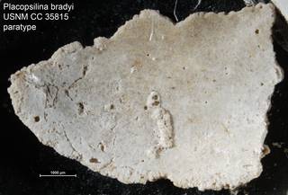 To NMNH Paleobiology Collection (Placopsilina bradyi USNM CC 35815 paratype)