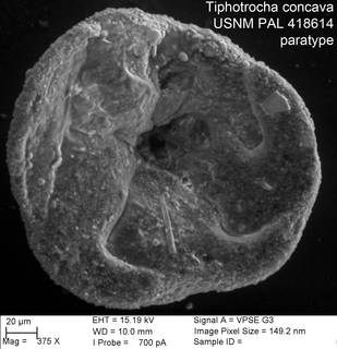 To NMNH Paleobiology Collection (Tiphotrocha concava USNM PAL 418614 paratype)