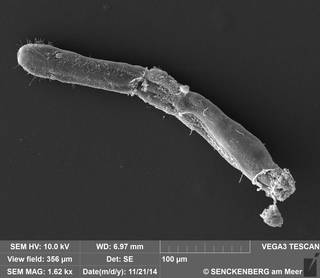 To NMNH Extant Collection (USNM 1274540 - Cephalodasys sp. nov. SN-141121-2A 141121-01, SEM)