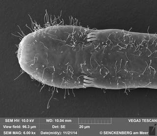 To NMNH Extant Collection (USNM 1274540 - Cephalodasys sp. nov. SN-141121-2A 141121-02, SEM)