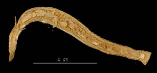 To NMNH Extant Collection (Pontobdella rugosa USNM 36348 specimen 1 sagittal section)